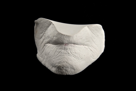 J.J. McCRACKEN Dunlevy Mouth Cast 4 alpha hemihydrate gypsum cement with lipstick residue